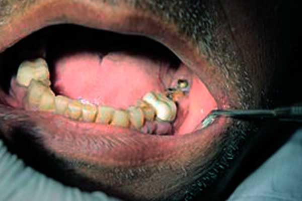 جراحة الأسنان