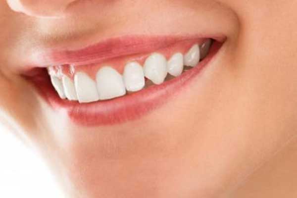 Hollywood smile transformation