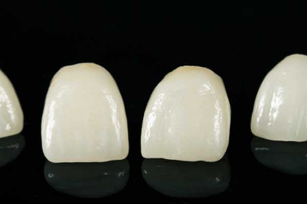 Carillas Dentales Turquía: La Clave para una Sonrisa Perfecta a un Precio Asequible