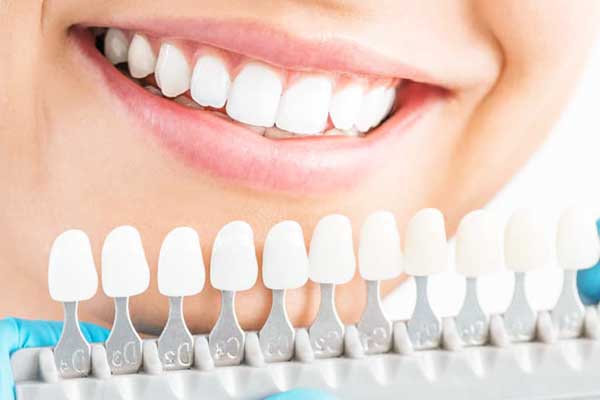 Discover Perfect Teeth in Turkey: Your Ultimate Guide to Dental Excellence