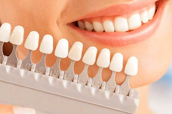 Clinica Denti Turchia: La Guida Completa al Sorriso Perfetto