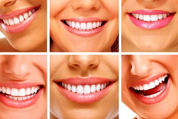 Rifarsi i Denti in Turchia: Le Migliori Recensioni e Consigli per un Sorriso Perfetto