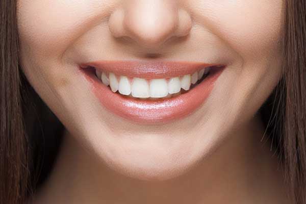 Quanto Dura l’Hollywood Smile? Scopri Tutti i Dettagli e Come Mantenere il Sorriso Perfetto