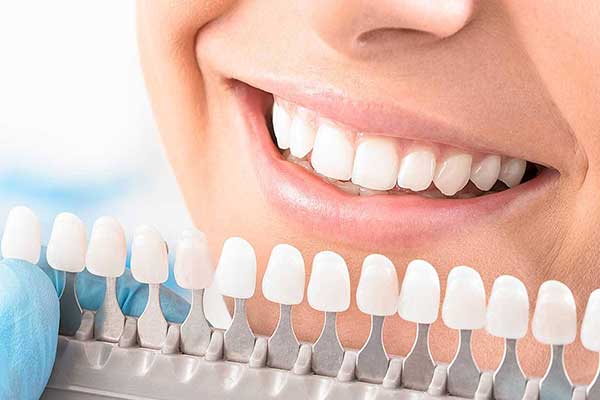 Recensioni Dentisti Turchia: La Guida Completa per Scegliere il Miglior Sorriso