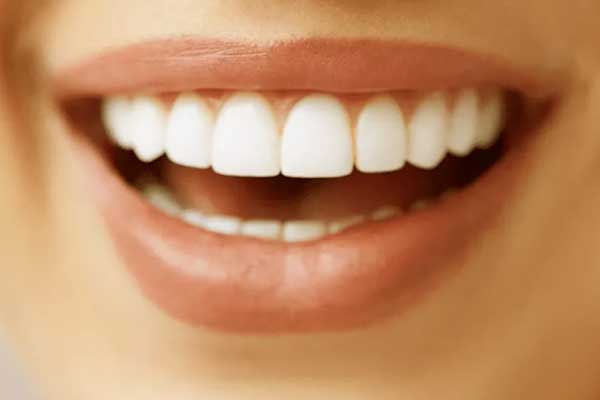 7 Alternatives to Turkey Teeth: Safe and Effective Options for a Perfect Smile