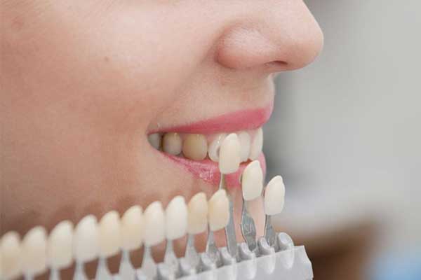 Dove farsi i denti in Turchia: La guida completa per un sorriso perfetto