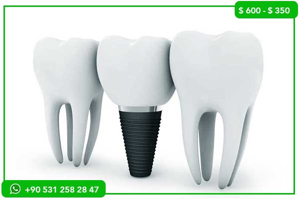 Precios de Implantes Dentales en Mauritania vs Turquía – ¡7 Razones por las que Turquía es la Mejor Opción!