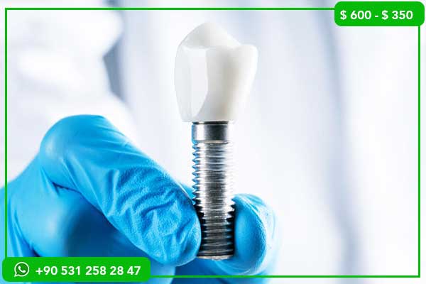 Dental Implant Prices in Iraq vs. Turkey – 10 Reasons Why Turkey is the Best Choice