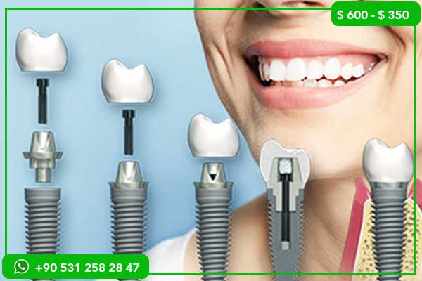 Teeth Whitening Turkey: 17 Expert Secrets for Safe, Fast & Long-Lasting Results