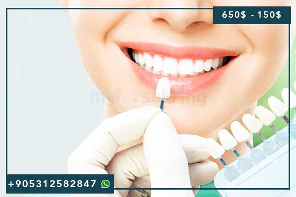Full Mouth Veneers Cost Turkey All Inclusive